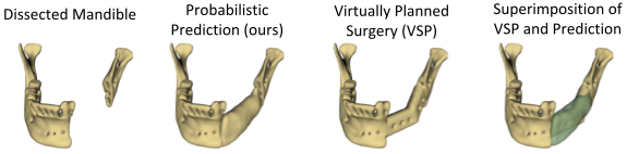 mandible.png