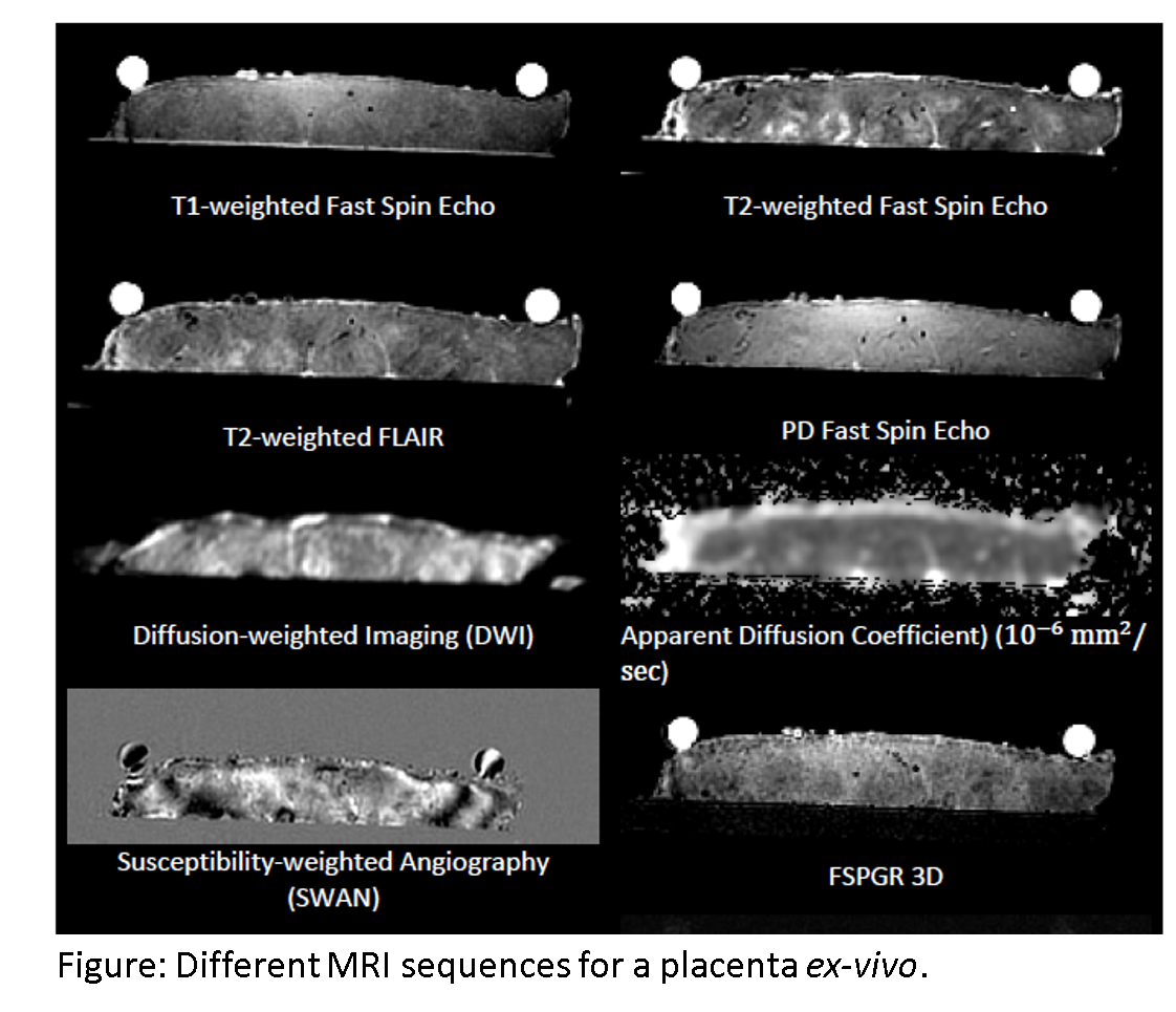 example graphic